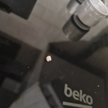 A101 Şubesinde Kombinet Hamburgerde Dişe Benzeyen Sert Cisim Bulundu