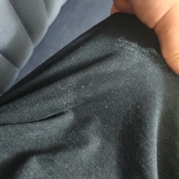 Molfix Yenidoğan Bezleri Sızdırıyor Ve İz Bırakıyor Bebek Sağlığı Tehlikede