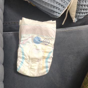 Molfix Yenidoğan Bezleri Sızdırıyor Ve İz Bırakıyor Bebek Sağlığı Tehlikede