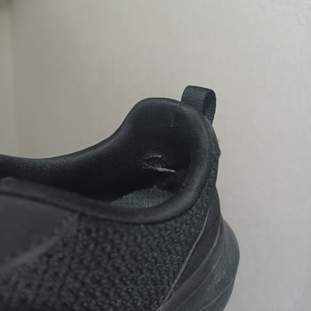 Skechers Ayakkabılarında Topuk Yarası Ve Mağaza İlgisizliği