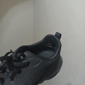 Skechers Ayakkabılarında Topuk Yarası Ve Mağaza İlgisizliği