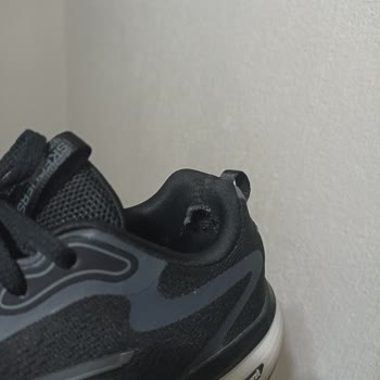 Skechers Ayakkabılarında Topuk Yarası Ve Mağaza İlgisizliği