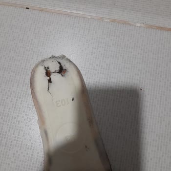 Kısa Sürede Kinetix Ayakkabısında Çökme Ve Mağazanın Kullanıcı Hatası İddiası