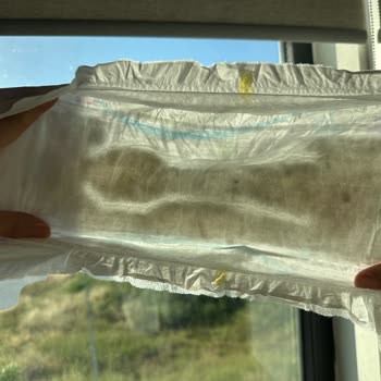 Molfix Bebek Bezinde Sap Eksikliği Ve Sağlık Endişesi