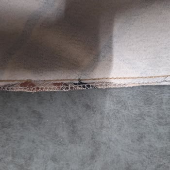 Bayram Elbisemde Dikiş Hatası Ve Cevapsız İletişim