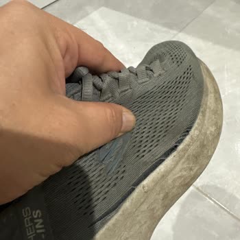 Deforme Ayakkabı Ve Garanti Çelişkisi: Trendyol Ve Skechers Sorumluluk İtirazı