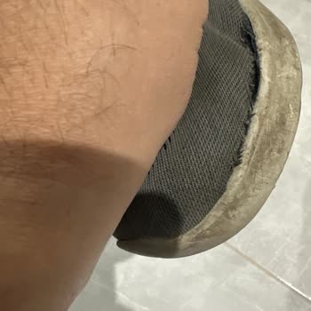 Deforme Ayakkabı Ve Garanti Çelişkisi: Trendyol Ve Skechers Sorumluluk İtirazı