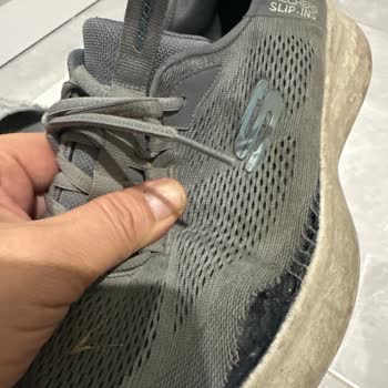 Deforme Ayakkabı Ve Garanti Çelişkisi: Trendyol Ve Skechers Sorumluluk İtirazı