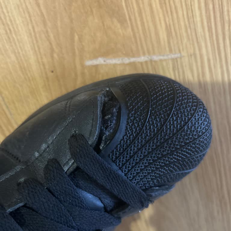 Adidas Superstar Ayakkabımda Üretim Hatası Ve Garanti Sürecinde İhmal