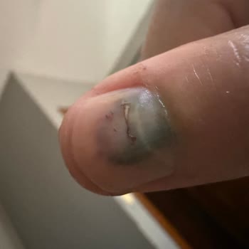 Ayıplı Brave Paws Çantası Kedimi Hayati Tehlikeye Attı