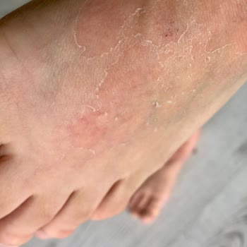 Trendyol Kozmonia Ayak Peeling Maskesi Mağduriyeti