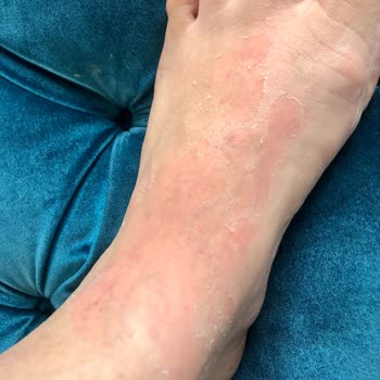 Trendyol Kozmonia Ayak Peeling Maskesi Mağduriyeti