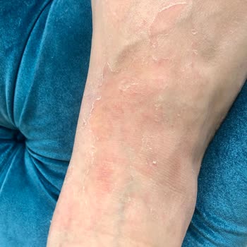 Trendyol Kozmonia Ayak Peeling Maskesi Mağduriyeti