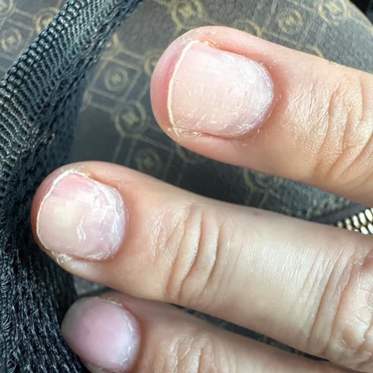 Cemile Kaya Nail Beauty Acı Veren Ve Sağlığımı Etkileyen İşlem