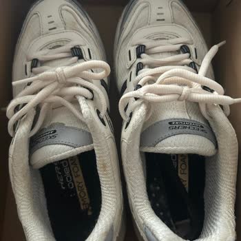Skechers Ayakkabı Astarı Kısa Sürede Ayrıldı, Kullanıcı Hatası İddiası Kabul Edilemez