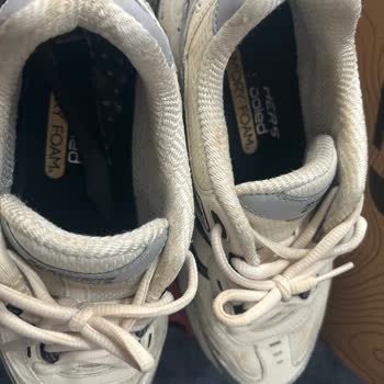 Skechers Ayakkabı Astarı Kısa Sürede Ayrıldı, Kullanıcı Hatası İddiası Kabul Edilemez