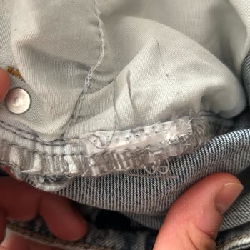 Etiket Alerjisi Nedeniyle İade Talebi Ve Mağaza İlgisizliği