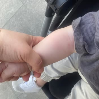 Kan Alma İşleminde Yetersiz Eğitimli Hemşire Çocuğu Ağrı Ve Travmaya Maruz Bıraktı
