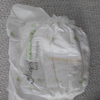 Sleepy Natural No 1 Newborn Bebek Bezinde İdrar Sızdırması Ve Pişik Sorunu