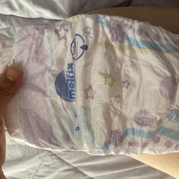 Molfix 6 Numara Bebek Bezlerinde Aşırı Sızdırma Ve Renk Farklılığı