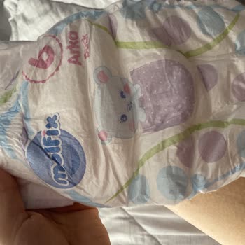 Molfix 6 Numara Bebek Bezlerinde Aşırı Sızdırma Ve Renk Farklılığı