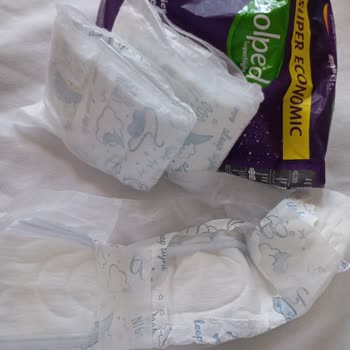 Molped Super Night Pedlerde Açık Paket Ve Kesik Kısımların Hijyen Problemi