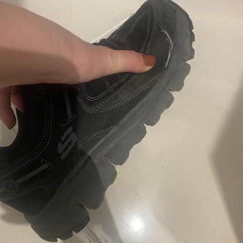 Skechers Ayakkabısının 4 Ayda Sökülmesi Ve Garanti Reddi