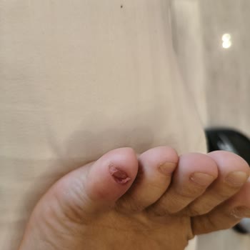 Bodrum Otelinde Hazırlıksızlık Ve Tatilbudur’un İlgisizliği