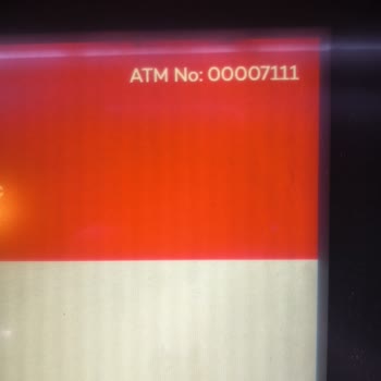 ATM Para Yatırma İşlemi Tamamlanmadı Ve Eksik Tutar Hesaba Yansımıyor