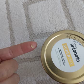 Antebella Süper Mix’te Fıstık Kabuğu Bulunması Çocukları Endişelendirdi