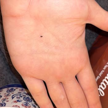 Granola Paketi İçinde Sinek Bulunması Ve Hijyen Endişesi