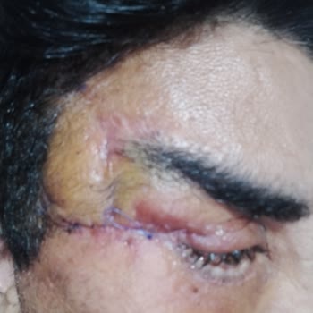 Prof. Dr. Ali Gürlek Estetik Ameliyat Hüsranı!