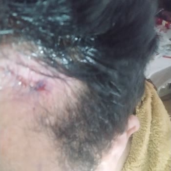 Prof. Dr. Ali Gürlek Estetik Ameliyat Hüsranı!