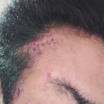 Prof. Dr. Ali Gürlek Estetik Ameliyat Hüsranı!