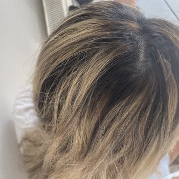 Reis Karakuş’taki Saç İşlemi Mahvoldu, 15 Bin Liraya Karşı Beklenen Sonuç Yok