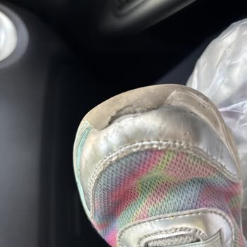 Skechers Çocuk Ayakkabısında Kısa Sürede Açılan Burun Ve Renk Atması Kullanıcı Hatası Olarak Reddedildi