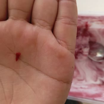 Yemekte Kırmızı Plastik Parça Çıktı, Ücret İadesi Ve Üretim Kontrolü Talebi