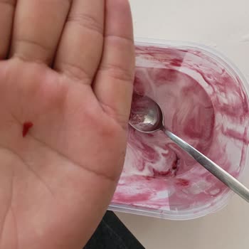 Yemekte Kırmızı Plastik Parça Çıktı, Ücret İadesi Ve Üretim Kontrolü Talebi