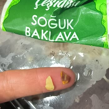 A101 Soğuk Baklavada Antep Fıstığı Kabuğu Bulunması Diş Tehlikesi Yaratıyor