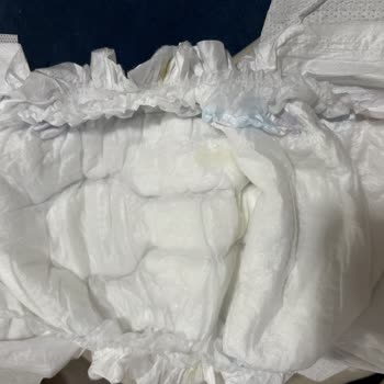 Molfix Bebek Bezinde Yapışkan Madde Bulundu