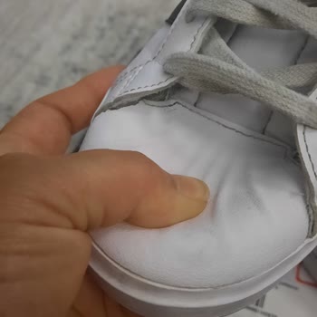Garanti Kapsamındaki Ayıplı Adidas Ayakkabının Kullanıcı Hatası Olarak Değerlendirilmesine İtiraz Ve Değişim Talebi