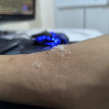 Acil Serviste Saygısız Davranış, Yanlış Damarlama Ve Uzun Bekleme Şikayeti