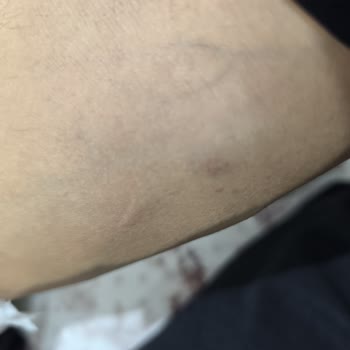 Acil Serviste Saygısız Davranış, Yanlış Damarlama Ve Uzun Bekleme Şikayeti