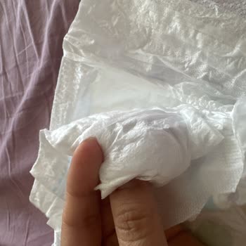 Molfix Mega Boy Bebek Bezinde Sert Parça Cilt Tahrişi Riski