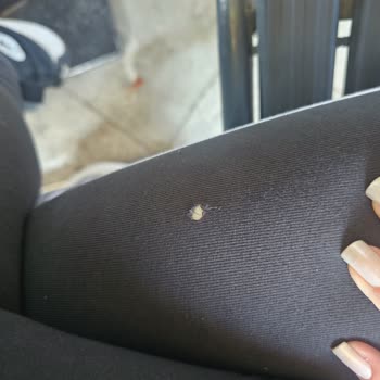 Demlik Café'de Çıkan Sandalye Riski Ve Çalışan Umursamazlığı