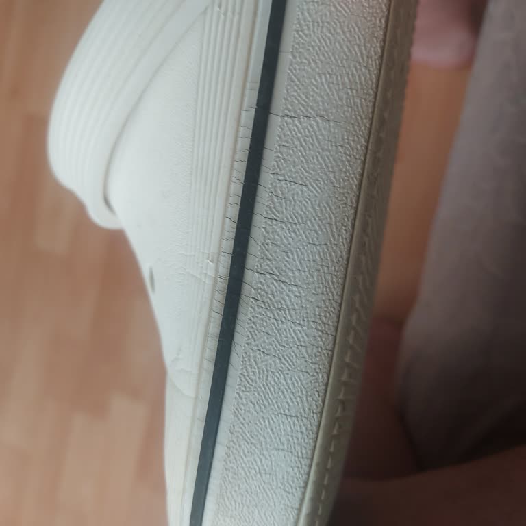 Crocs Terliklerde Yan Şerit Çatlaması Ve Garanti Süresi Sorunu