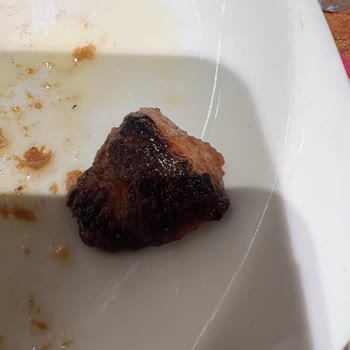 Metal Çatal Ve Bıçak Eksikliği Şikayetim
