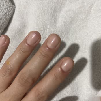 Esra Ünlütürk Beauty & Aesthetics Tırnak Ve Çevresinde Şişlik, Kızarıklık Ve Kanama Oluştu