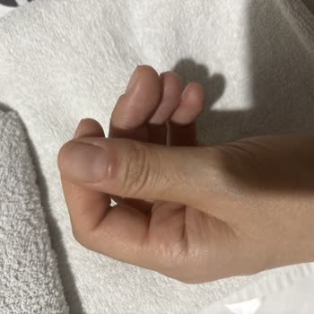 Esra Ünlütürk Beauty & Aesthetics Tırnak Ve Çevresinde Şişlik, Kızarıklık Ve Kanama Oluştu