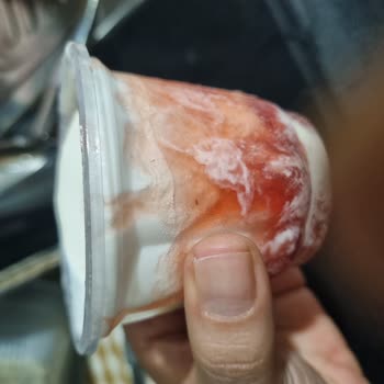 Çocuk Menüsündeki Dondurmanın İçinden Çıkan Yabancı Cisim Ve Trendyol’un Destek Sorunu